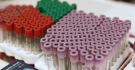 Ministerstwo Zdrowia: od 16 do 22 czerwca wykryto 1341 zakażeń, zmarło 17 osób z COVID-19