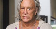 Dlaczego Mickey Rourke TAK wygląda? Ekspert wskazał na niebezpieczne połączenie