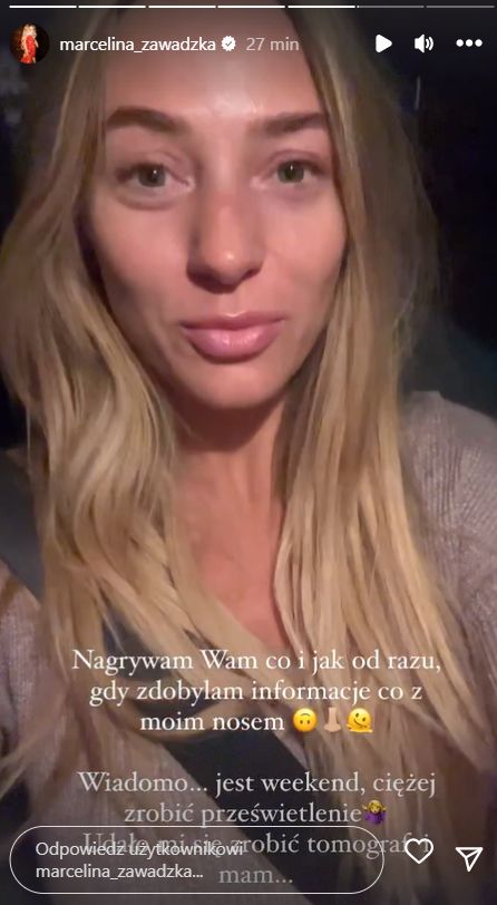 Marcelina Zawadzka miała wypadek. Co się stało? (fot. InstaStories)