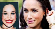 Zabiegi chirurgiczne Meghan nie stanowią już tajemnicy. W sieci pojawiły się konkretne DOWODY na to, co zmieniła w swoim wyglądzie
