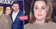 Danuta Martyniuk pokazała się w "PnŚ" po liftingu twarzy i operacji nosa. Wiadomo, jak Zenek zareagował na metamorfozę