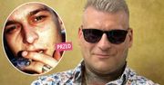 Popek pociął sobie twarz, żeby się "upiększyć". Jak teraz wygląda? Zdjęcia po metamorfozie