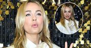 Małgorzata Socha w trakcie eventu miała poważny problem z uśmiechaniem się. Wszystko przez zabieg. Niczego nie zataiła przed reporterami