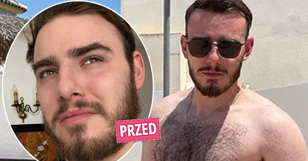 Krystian Ochman przeszedł metamorfozę. Jedno spojrzenie na twarz i widzimy, co zmienił! Jest nie do poznania