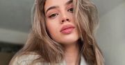 Stare zdjęcia Weroniki Zoń z "Top Model". Trudno uwierzyć, że jej skóra aż tyle przeszła