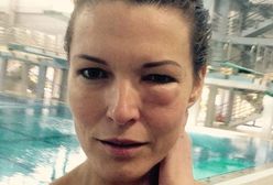 "Celebrity Splash": Ilona Felicjańska pierwszą ofiarą skoków do wody