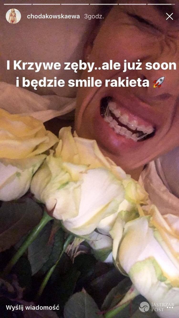 Ewa Chodakowska pokazała krzywe zęby - Instagram