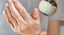 Drętwieją ci dłonie i stopy? Znak, że brakuje kluczowej witaminy