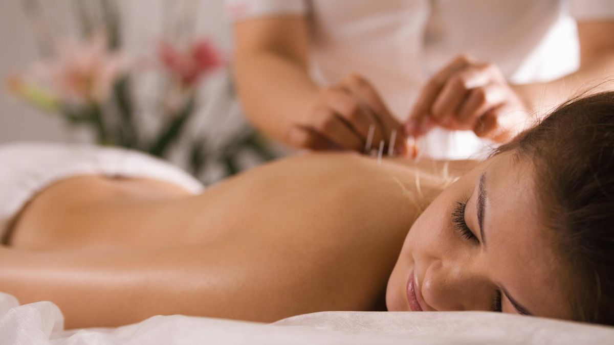 Tradycyjnie, punkty akupunktury były pobudzane igłami, jednak obecnie coraz popularniejsze stają się zioła, magnesy, lasery i działanie prądem.