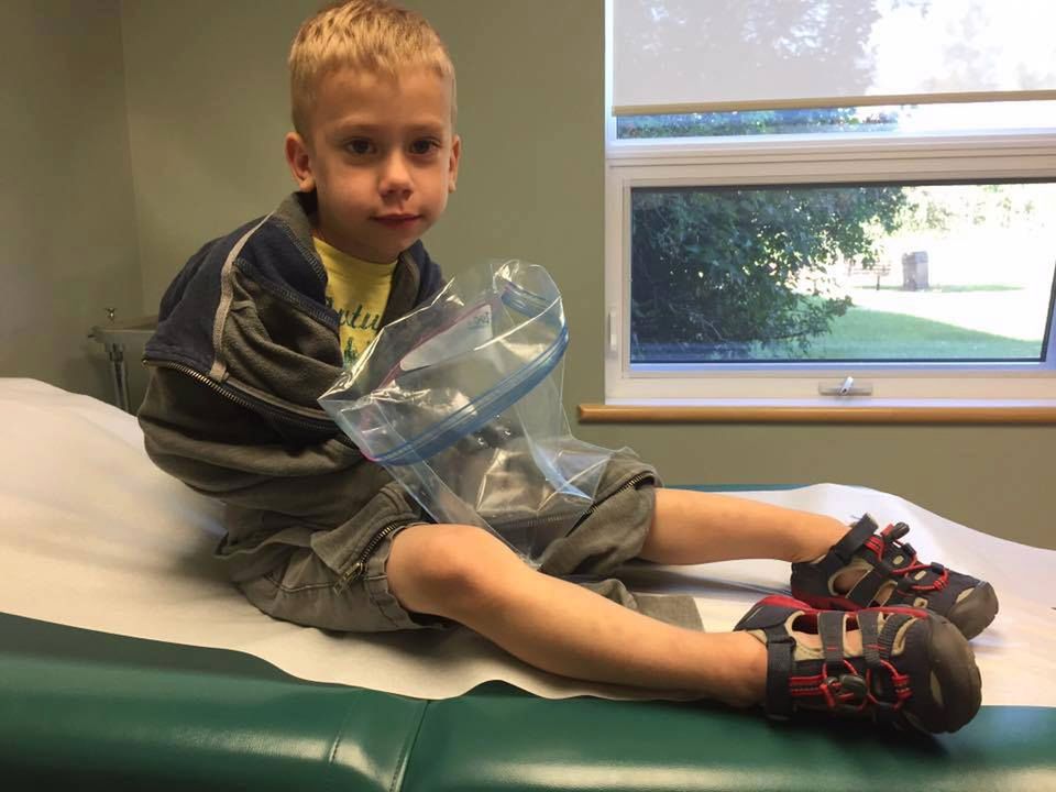 Mały Ollie miał zabieg wyciągania metalu z ciala