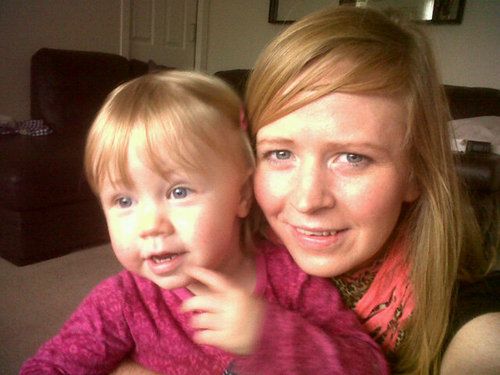 Była uczulona na własną ciążę