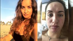 Przez pleśń w mieszkaniu poważnie zachorowała (WIDEO)