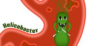 Helicobakter pylori test - charakterystyka bakterii, czynniki ryzyka zakażeń, wskazania do diagnostyki, test,  choroby wynikające z zakażenia, leczenie, profilaktyka
