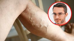 Sprzyjają tworzeniu się żylaków. Flebolog ostrzega