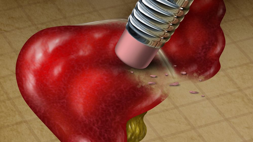 Woreczek żółciowy bierze udział w procesie trawienia 