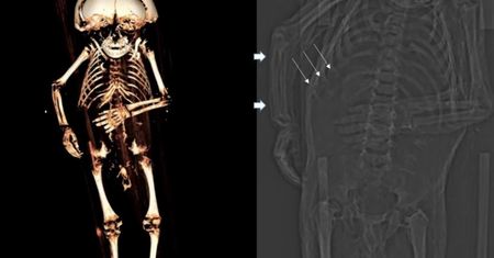 Kalekie dzieciństwo. W średniowieczu dzieci były głównie tanią siłą roboczą