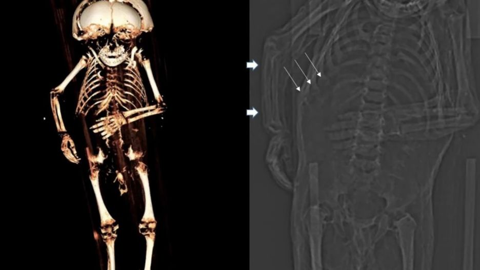 Dzieci były głównie tanią siłą roboczą. Kalekie dzieciństwo