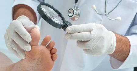 Grzybica stóp - rodzaje, przyczyny, objawy, diagnostyka, leczenie