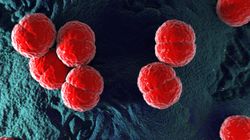 Meningokokowe zapalenie opon - przyczyny, objawy, leczenie