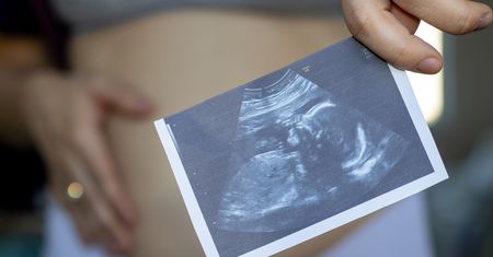 Fetus in fetu – jak rozpoznać bliźniaka pasożytniczego?