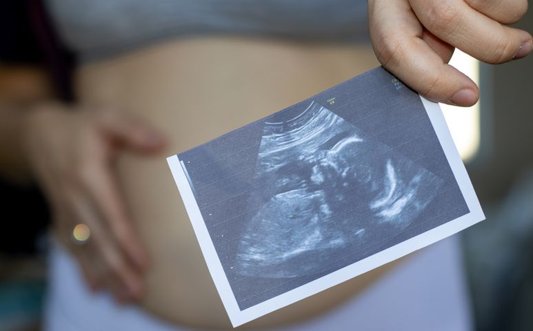 Fetus in fetu to niezwykle rzadka nieprawidłowość