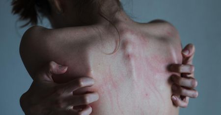 Coraz więcej przypadków dwubiegunówki u dzieci. "Najmłodszy pacjent ma 12 lat"
