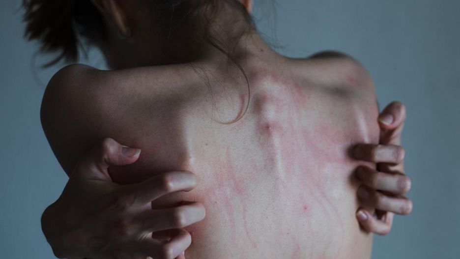 Coraz więcej przypadków dwubiegunówki u dzieci. "Najmłodszy pacjent ma 12 lat"