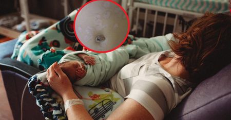 Niemowlę cierpiało z powodu choroby wenerycznej. Takie objawy dawała kiła