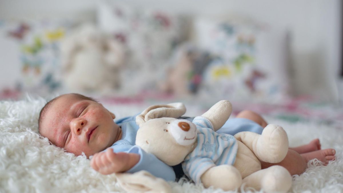 Dzieci a alergia kontaktowa