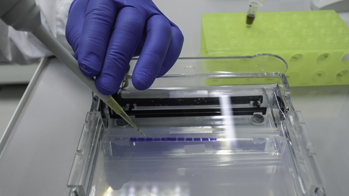 Proteinogram to elektroforetyczne badanie krwi