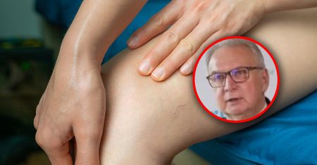 Prowadzi do zakrzepicy. "Dla żył to jest absolutny dramat"