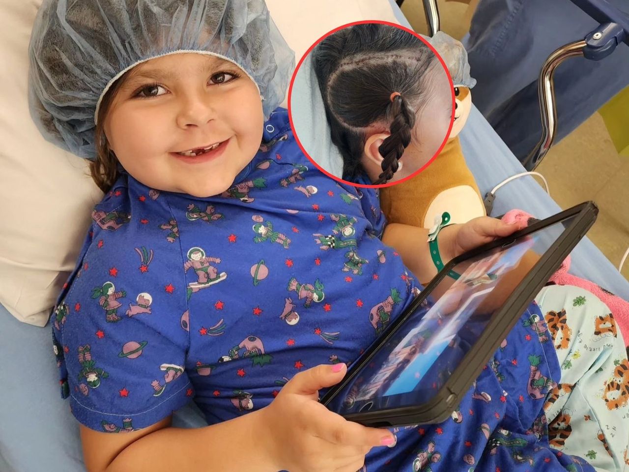 6-latce "wyłączono" połowę mózgu. Choroba ustąpiła