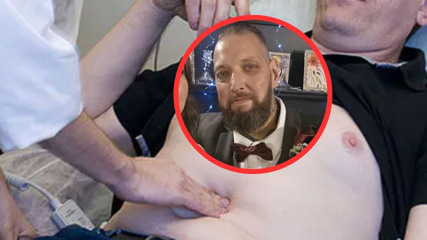 Nagle "zrobił się żółty". Tak objawiał się nowotwór