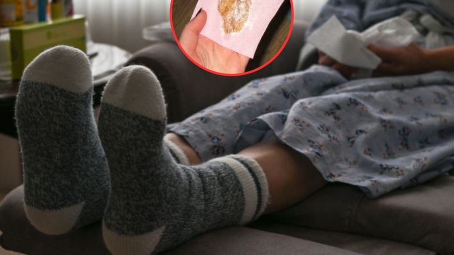 Kaszel nie przechodzi? Domowy sposób może zdziałać cuda