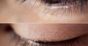 Wszy na sztucznych rzęsach. Lekarze ostrzegają kobiety