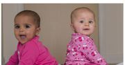Na świat przyszły bliźniaczki o różnym kolorze skóry