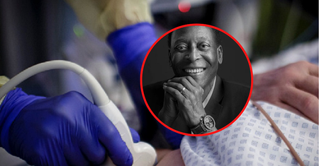 Pele zmarł na raka jelita grubego. Oto najbardziej ignorowany objaw tego nowotworu