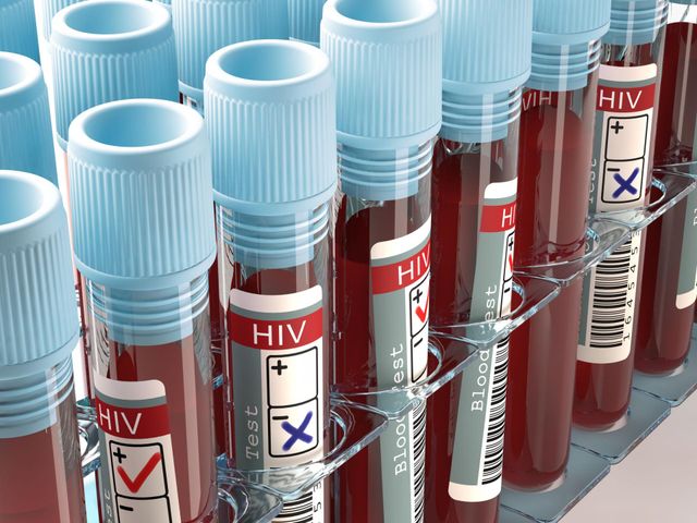 Według danych WHO na świecie żyje ok. 36,9 mln osób zarażonych wirusem HIV