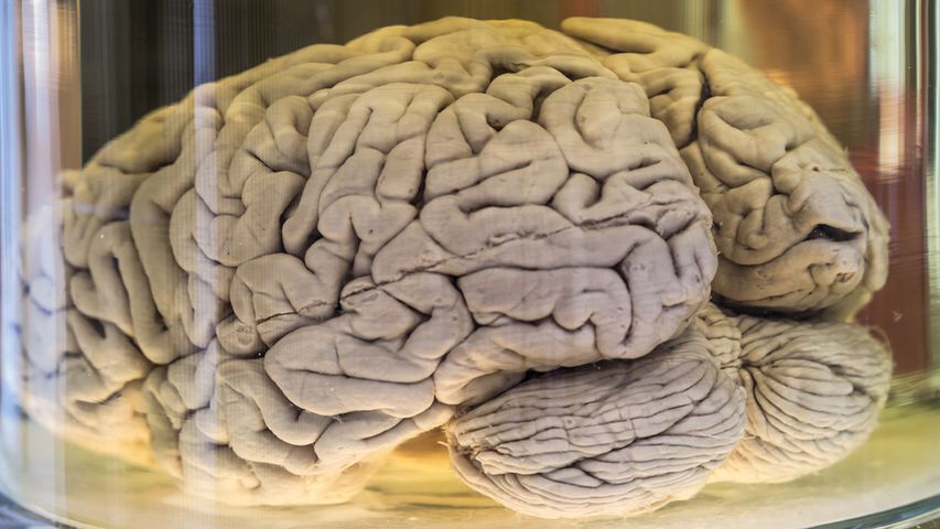 Naukowcy wyhodowali ludzki mózg
