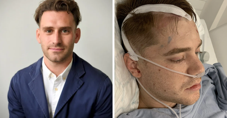 Pierwszym objawem był "zapach palonej gumy". U 34-latka zdiagnozowano agresywny guz mózgu