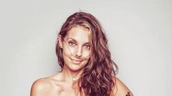 Śmiertelnie chore i piękne - niezwykły projekt cenionego fotografa