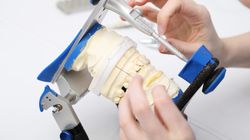 Objawy chorób żuchwy - choroby, diagnostyka, leczenie 