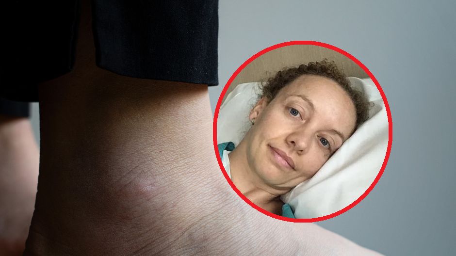 Przeszła dwa zawały serca przed 40. rokiem życia