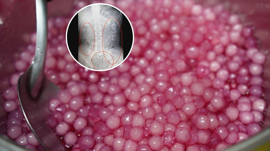 Niebezpieczne bąbelki. Taka herbata może zatkać jelita