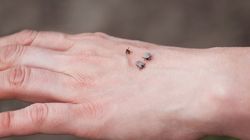 Naukowcy biją na alarm. Rośnie liczba rozpoznań choroby z Lyme