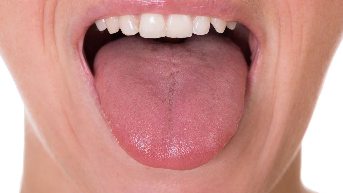 Rak języka jest bardzo groźny, ponieważ szybko daje przerzuty, co utrudnia leczenie. Jakie są jego objawy?