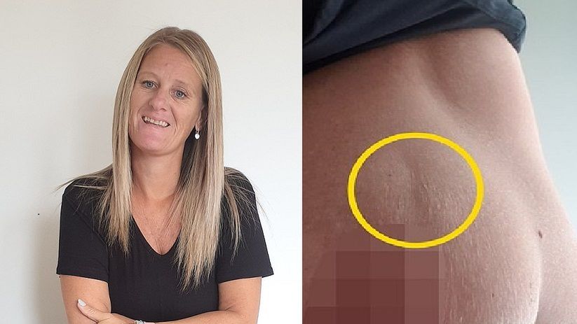 Demelza myślała, że to rozstęp