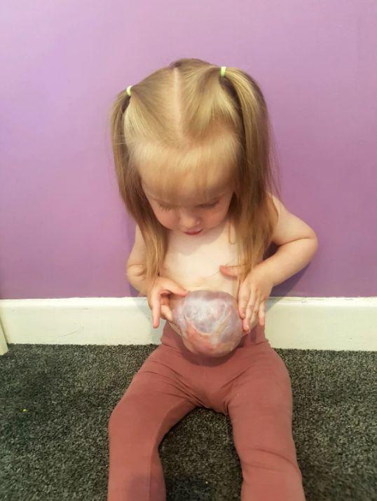 Dziewczynka musiała żyć z organami na wierzchu przez 3 lata