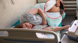 Zachoruje co trzecia osoba po ospie. Wirus może uaktywnić się po latach