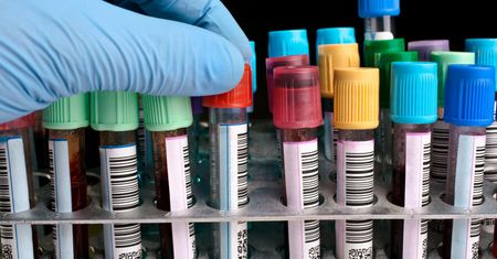 Badania krwi. Co możemy z nich wyczytać? #ZdrowaPolka